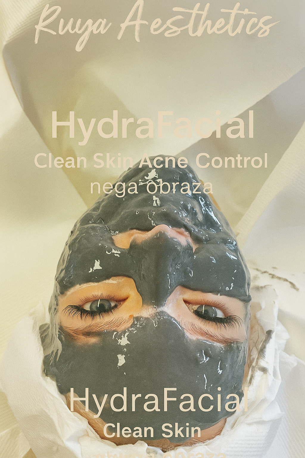 Ngea obraza v Ruya Aesthetics